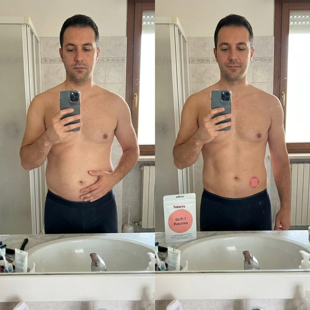 Naturyx Burn+™ –  Slimming Patches